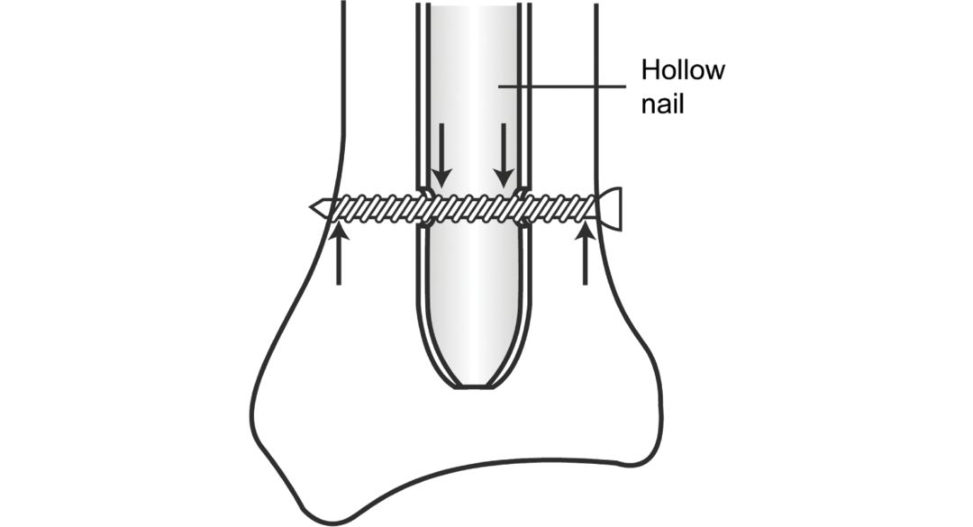 Figure 9.5